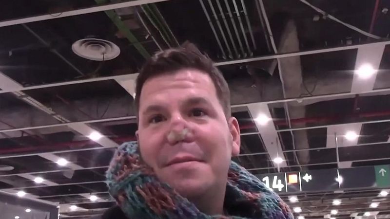 Exclusiva Mamarazzis: El nas d’en Lucas requerirà una costella i retocs finals