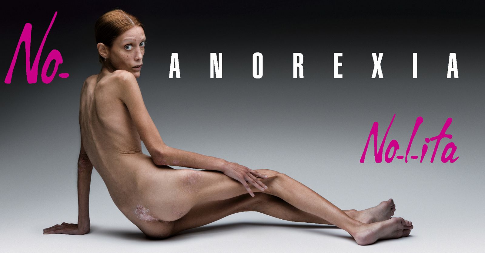 La campaña "Nolilita" pretende concienciar sobre los peligros de la anorexia