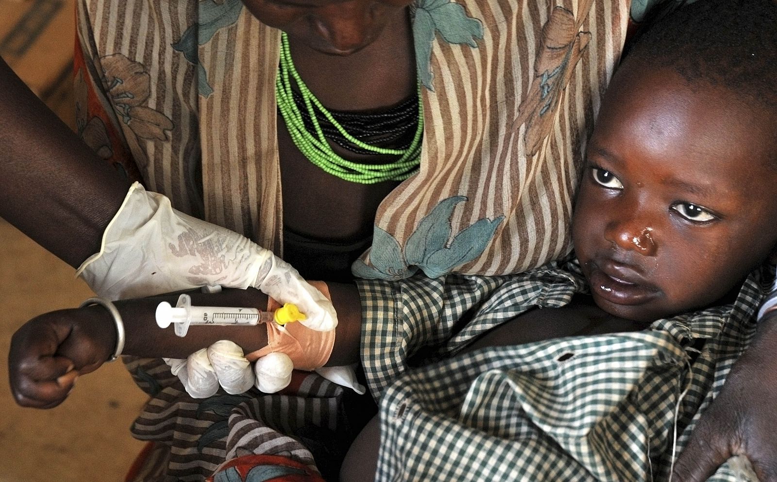 Un niño de Uganda es tratado en un hospital de Moroto.