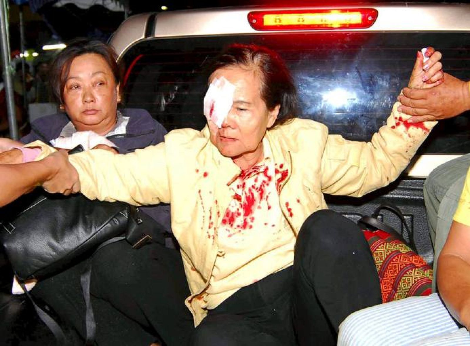 Opositoras al gobierno tailandés son trasladadas al hospital después de que una granada hiciera explosión en las cercanías de la Casa Presidencial en Bangkok.