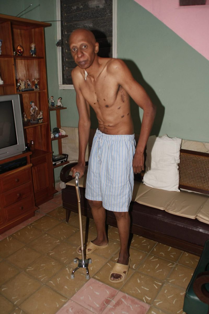 CUBANO EN HUELGA DE HAMBRE VUELVE A CASA TRAS RECOBRAR CONCIENCIA EN HOSPITAL