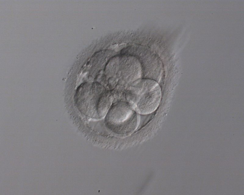 Sanidad propone limitar la reproducción asistida a problemas de fertilidad.