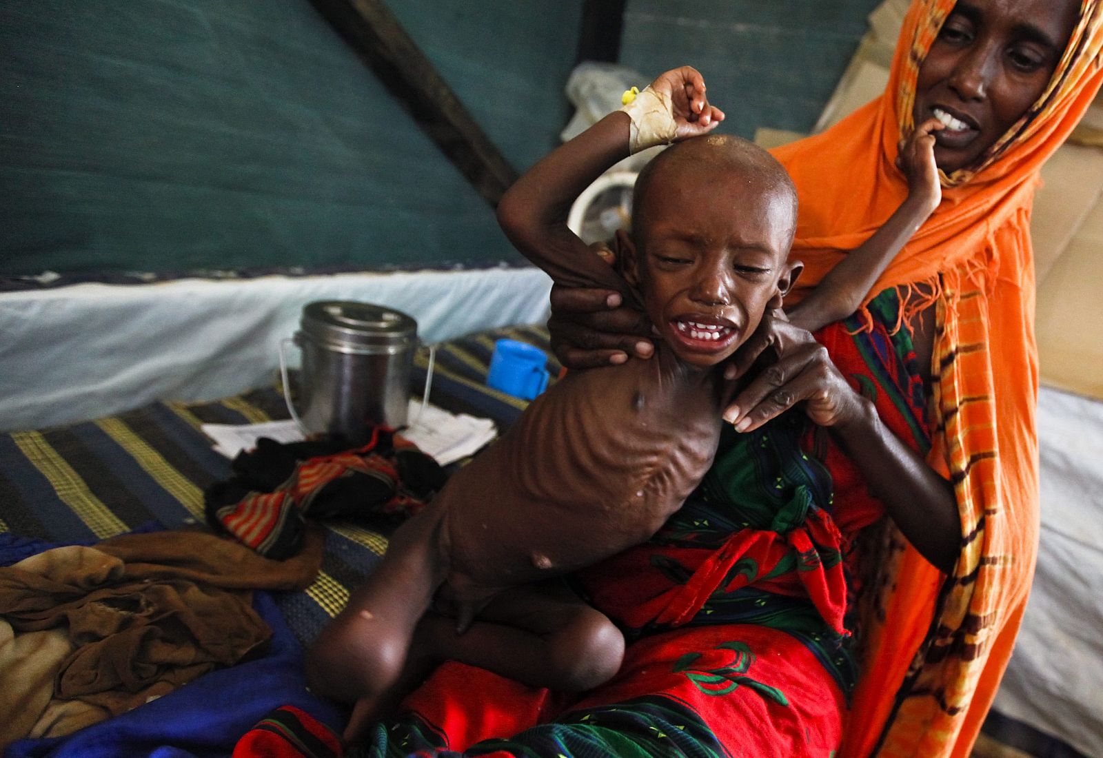 La ONU declara la situación de hambruna en dos regiones del sur de Somalia