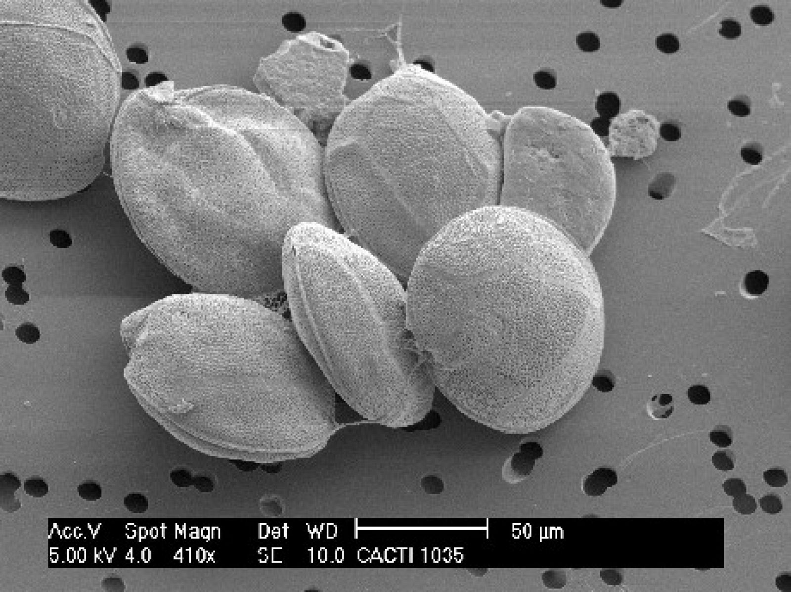 Imágenes microscópicas de la nueva microalga