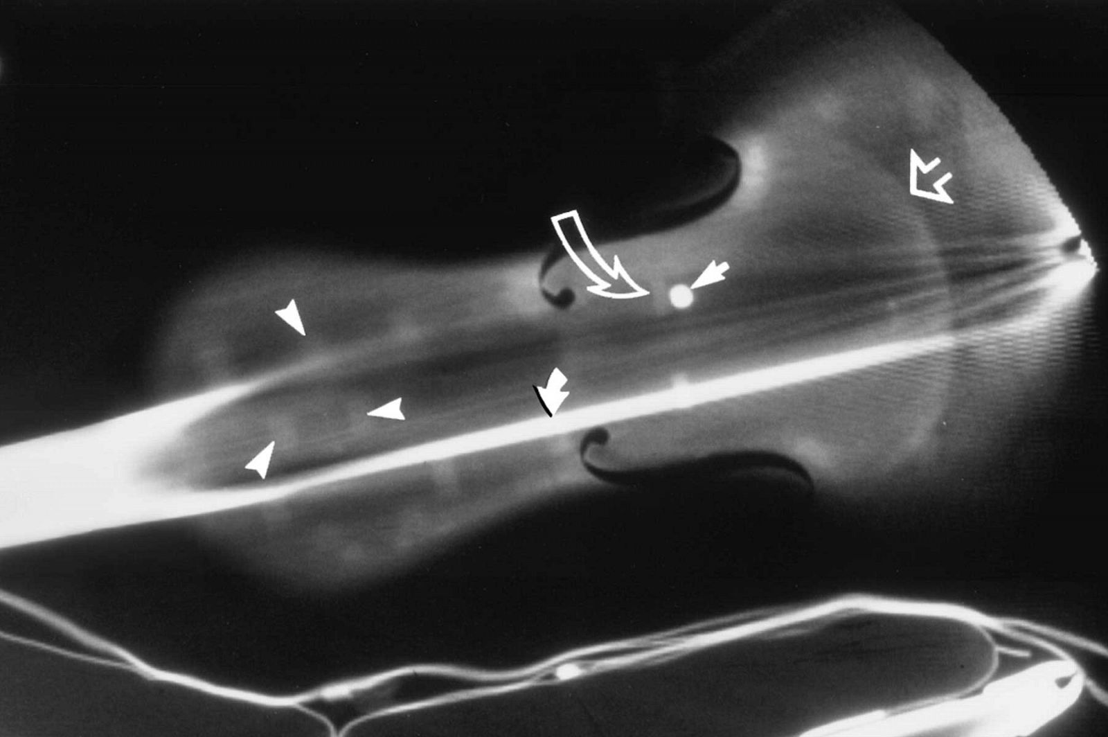 Imagen TC de un violín Stradivarius. Más de 1.000 imágenes obtenidas de tomas de rayos X se utilizaron para reproducir este preciado instrumento.