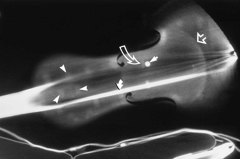 Imagen TC de un violín Stradivarius. Más de 1.000 imágenes obtenidas de tomas de rayos X se utilizaron para reproducir este preciado instrumento.