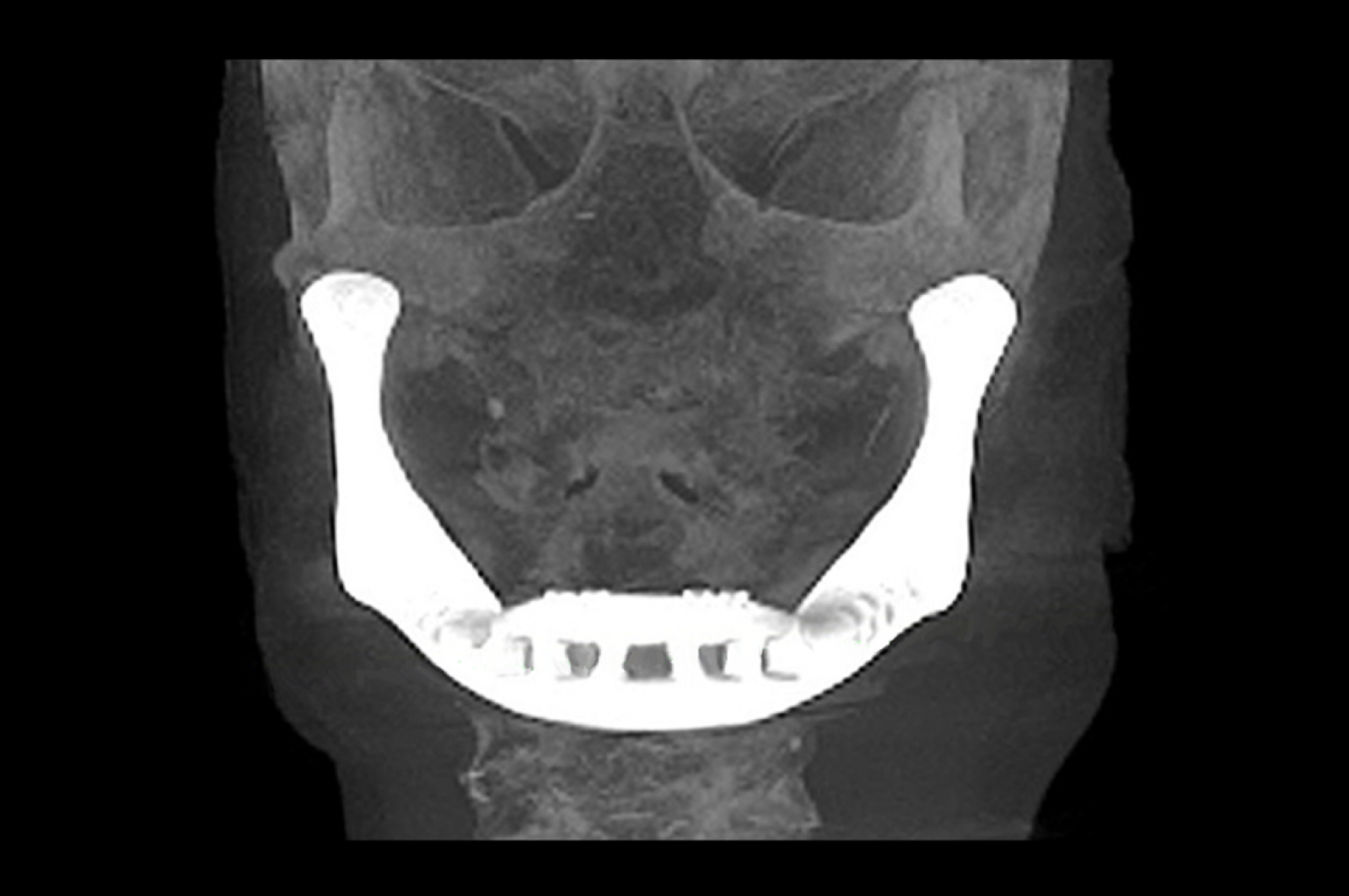 xilloc medical - press 6