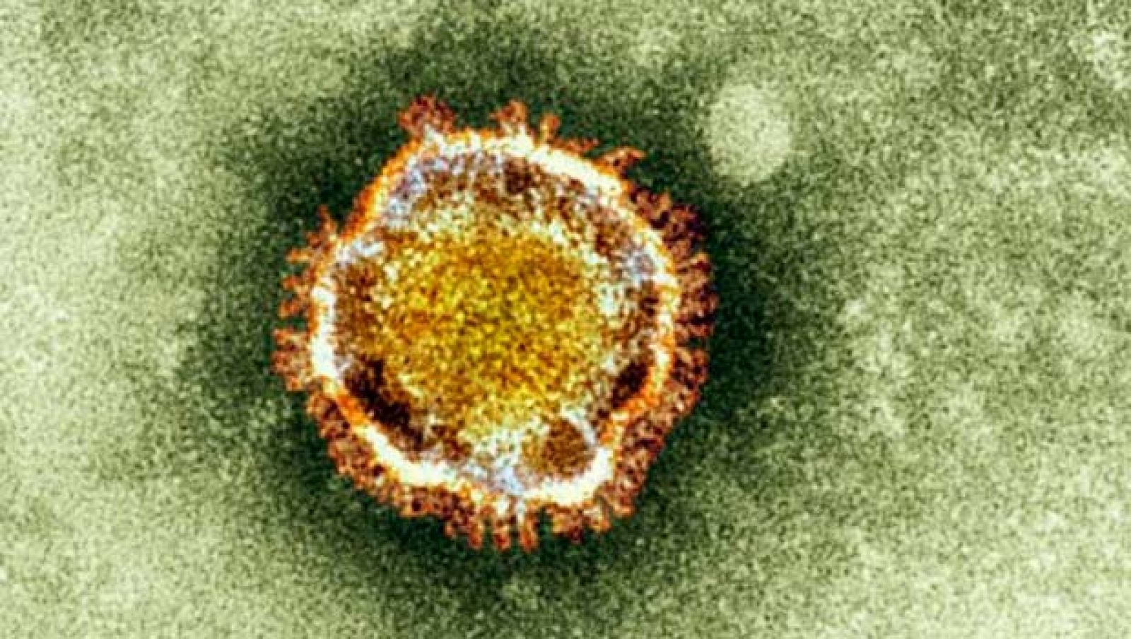 Una imagen de microscopio de un coronavirus