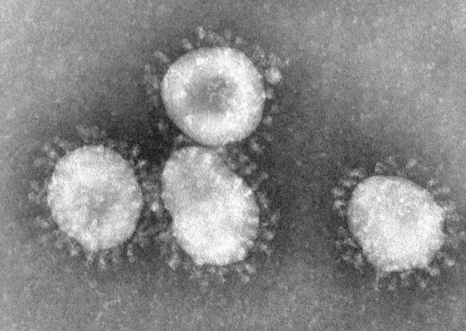 Imagen de microscopio de un coronavirus.
