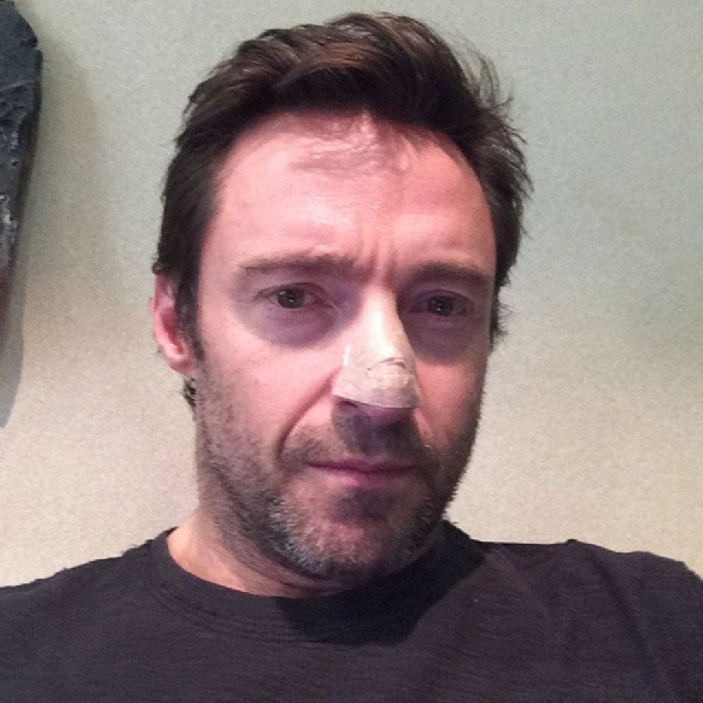 La foto que publicó Hugh Jackman en Instagram con una tirita en la nariz tras revelar que padece un carcinoma.