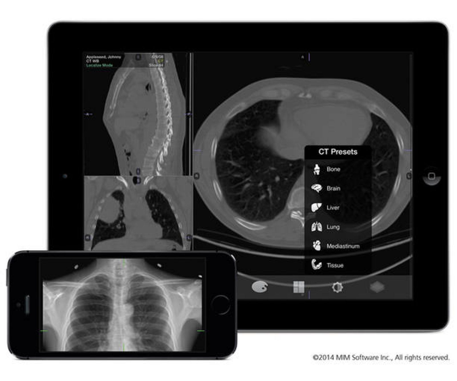  Una radiografía de los pulmones en un móvil y en una tableta.