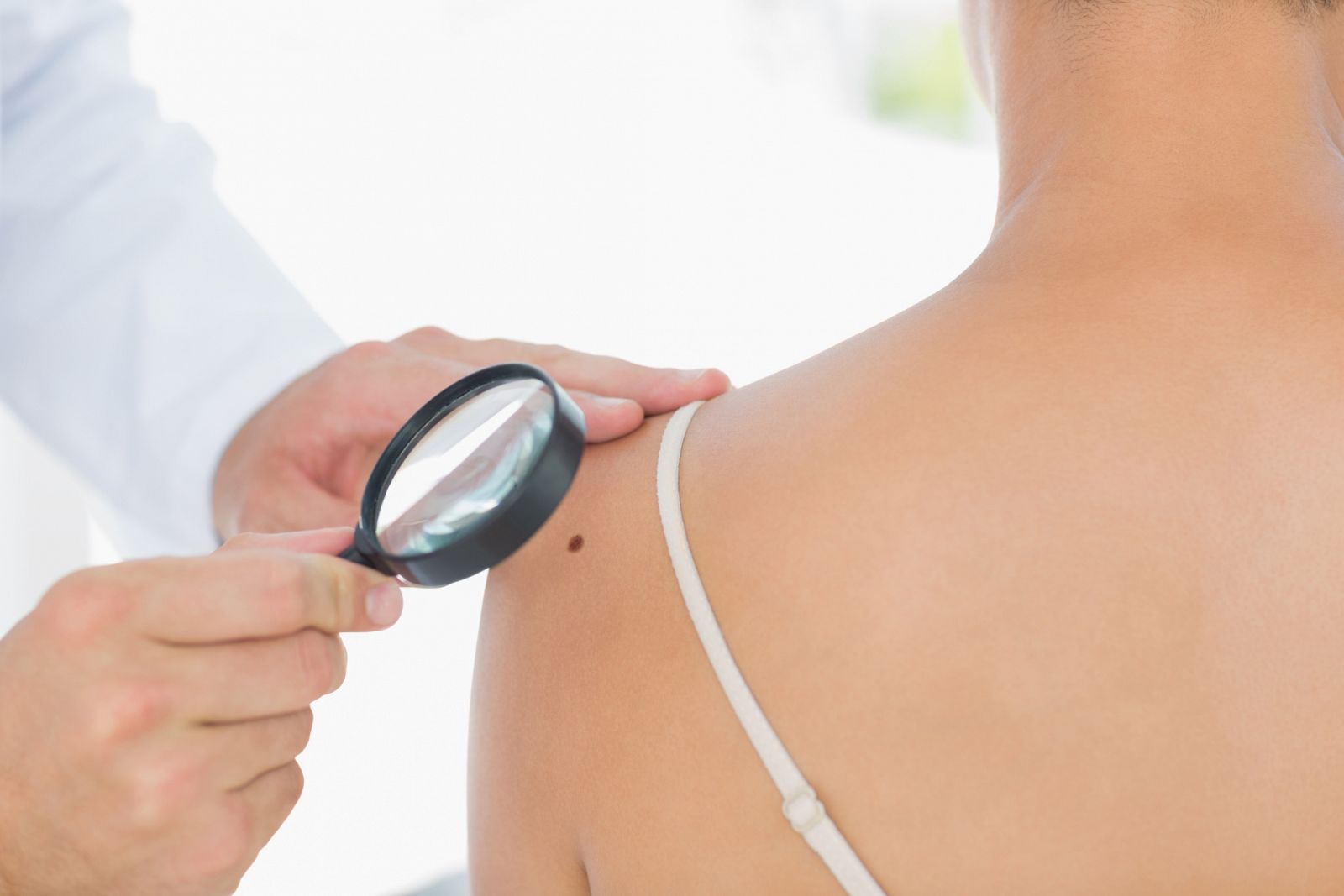 Médico examinando un melanoma en una mujer.