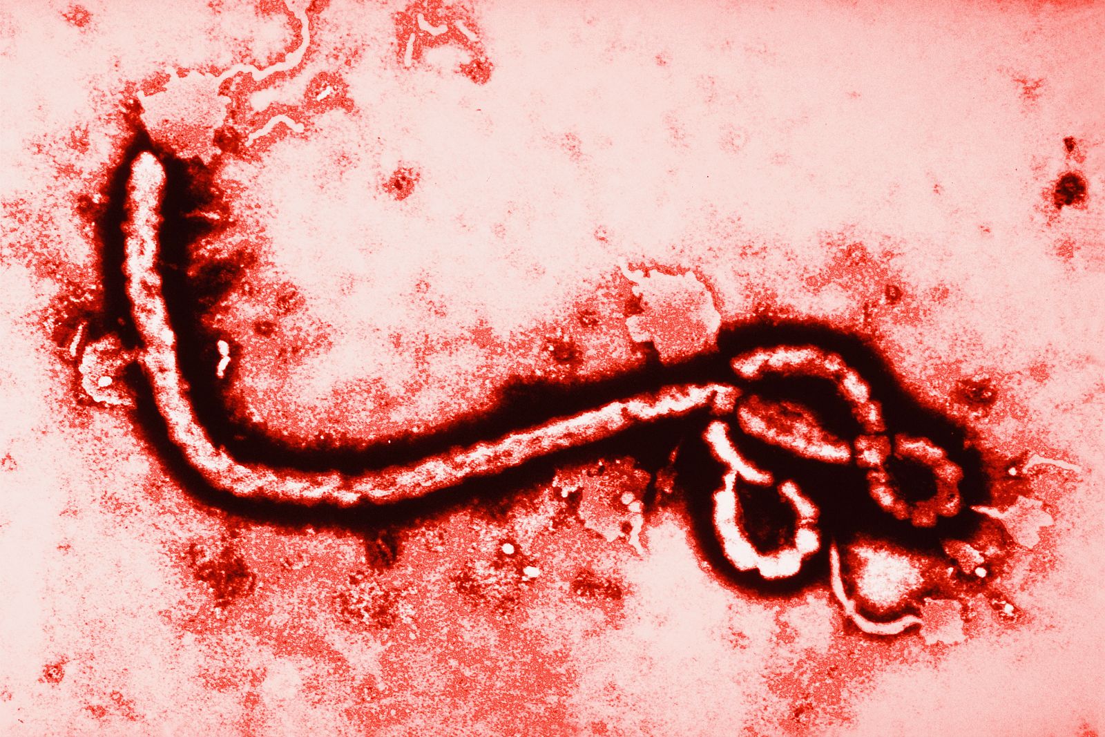 Imagen del virus del ébola, ampliado 108.000 veces.