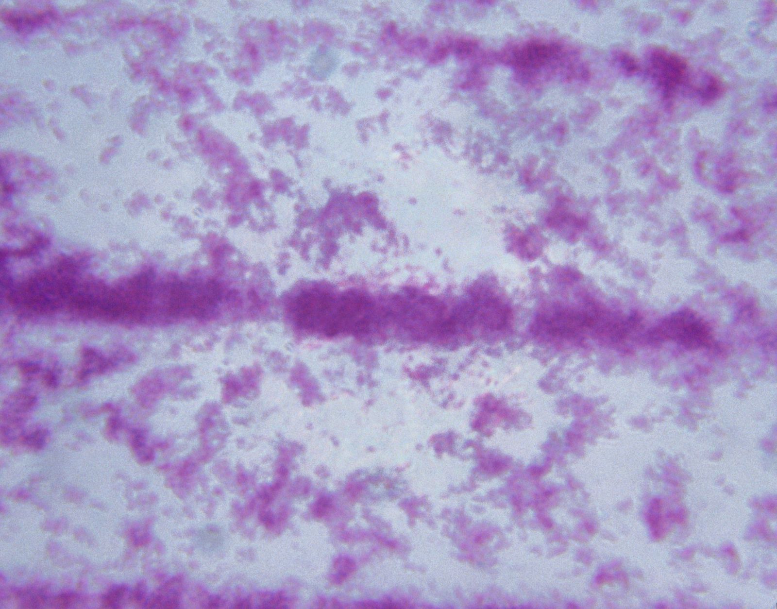 Imagen microscópica de la bacteria de la tuberculosis