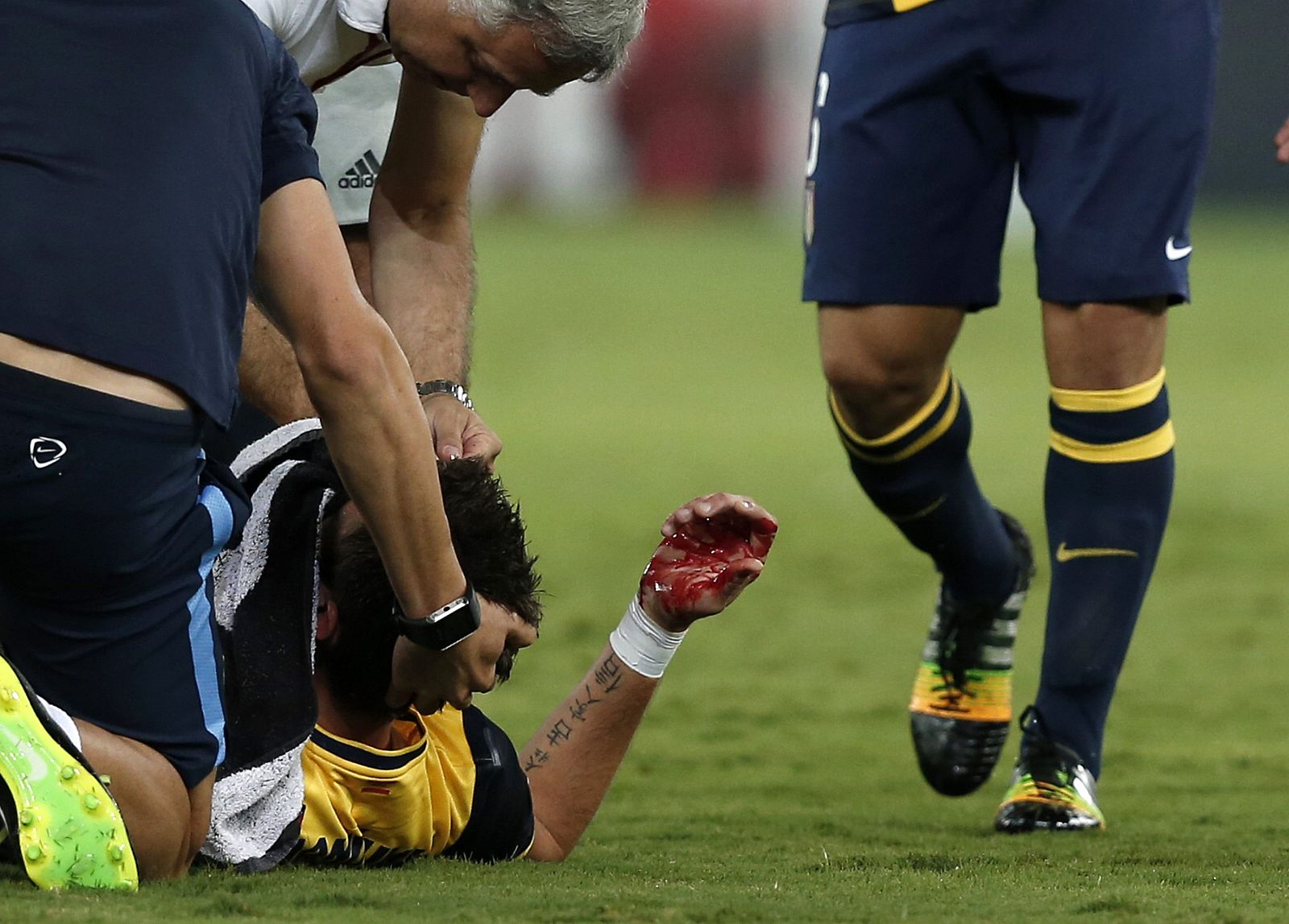 Mario Mandzukic, atendido tras sufrir el codazo en la nariz