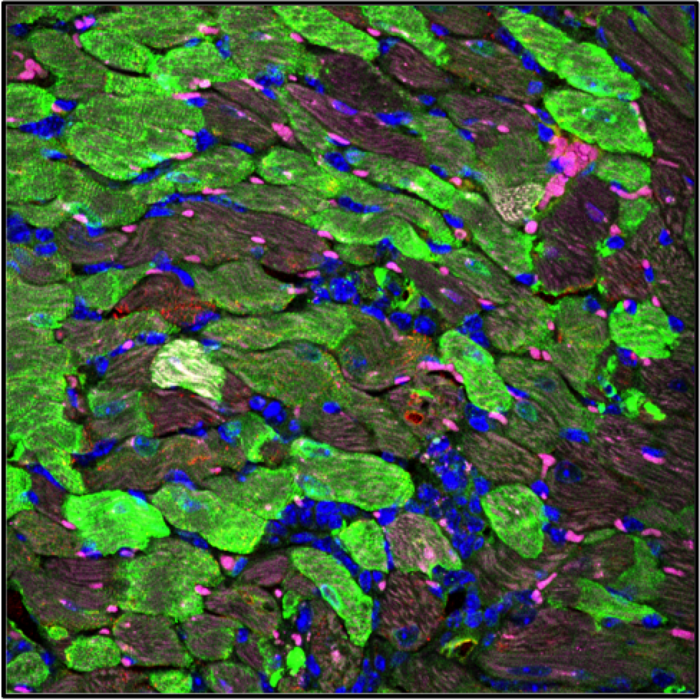 Imagen aumentada del corazón. Las células en color verde representan los cardiomiocitos que han sido sometidos a la terapia génica.