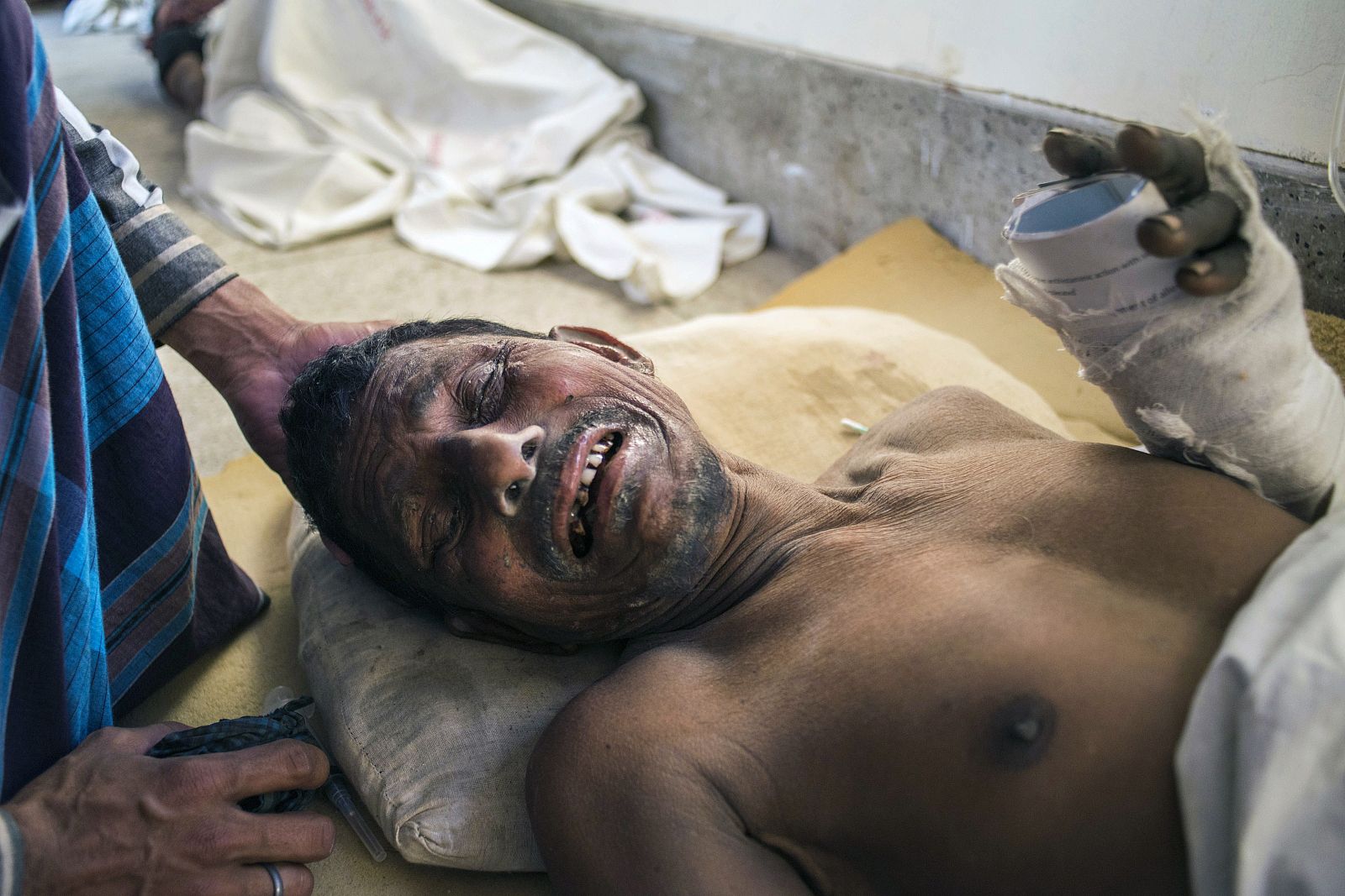 Uno de los heridos del derrumbe de una fábrica en Mongla, Bangladesh