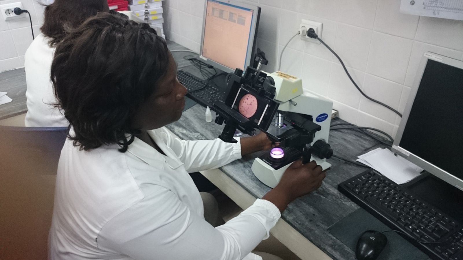 Digitalización de muestras de malaria con un móvil acoplado a un microscopio