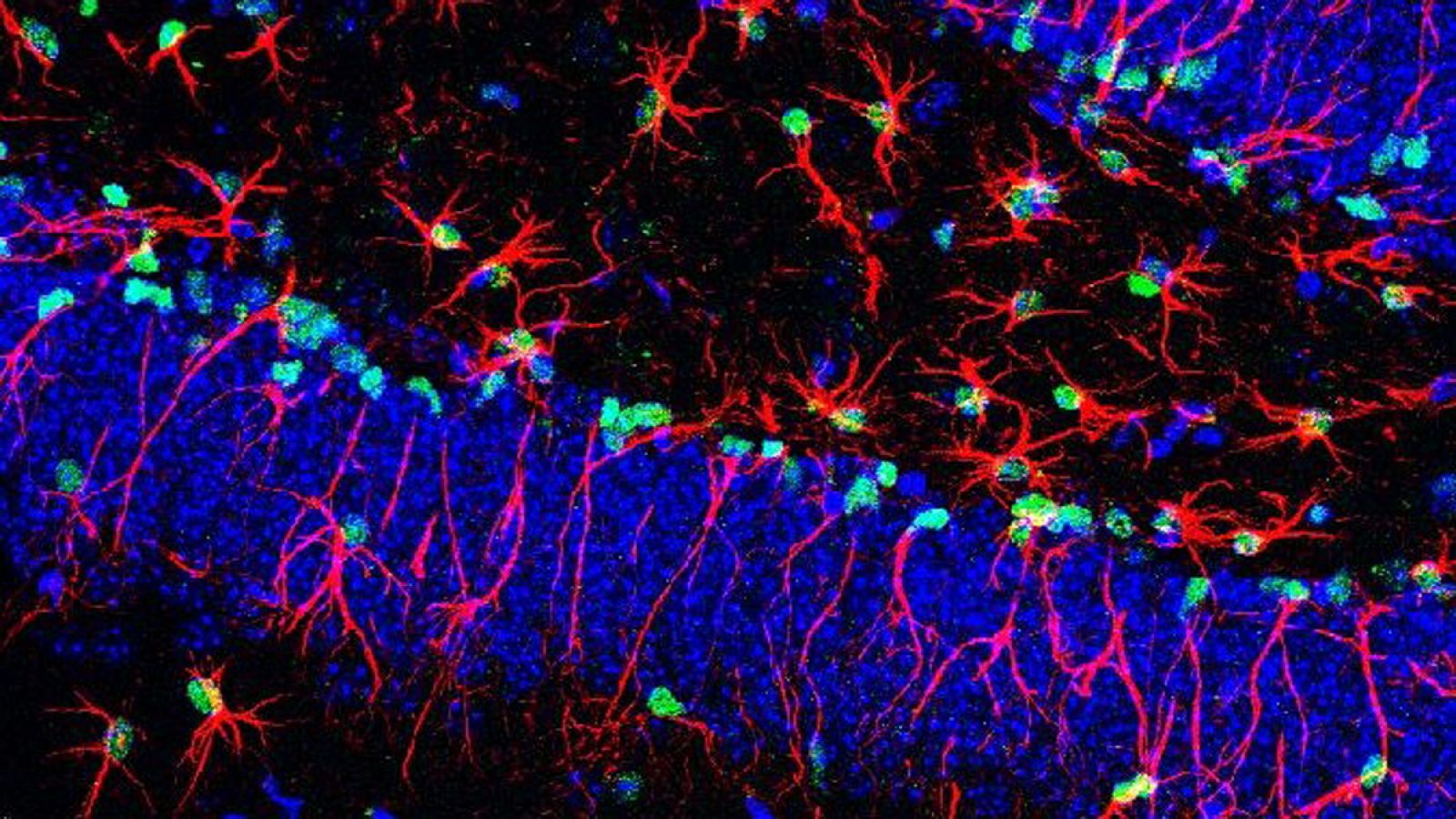 Imagen de células madre cerebrales implicadas en la producción de nuevas neuronas