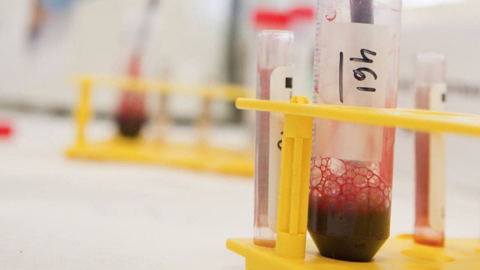 España ha alcanzado los 190.000 donantes de médula en el primer semestre del año.