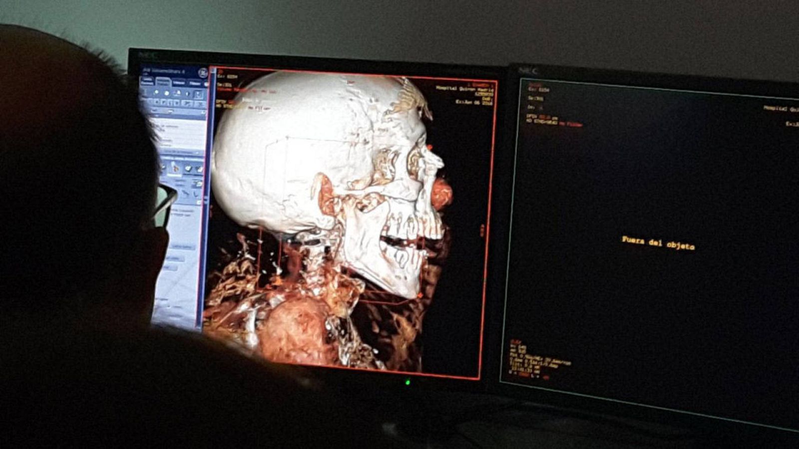  Una de las primeras imágenes reveladas tras el escaneo de las momias