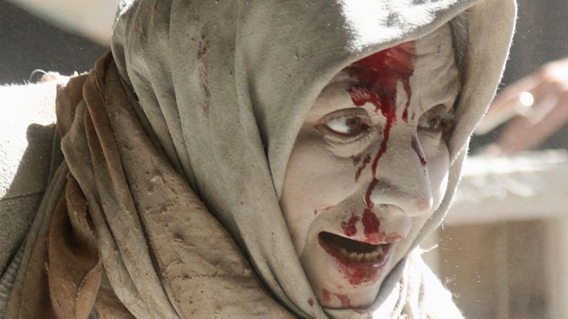 Vecina de la ciudad siria de Alepo herida tras un ataque aéreo lanzado en abril contra el casco antiguo de la ciudad