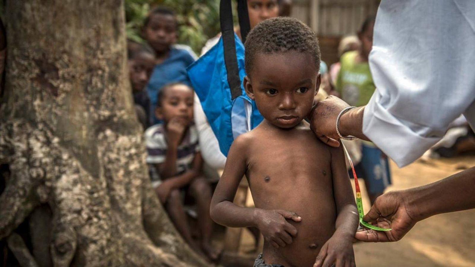 Una mujer toma medidas de un niño en un centro de ayuda de UNICEF en Tolanaro (Madagascar)