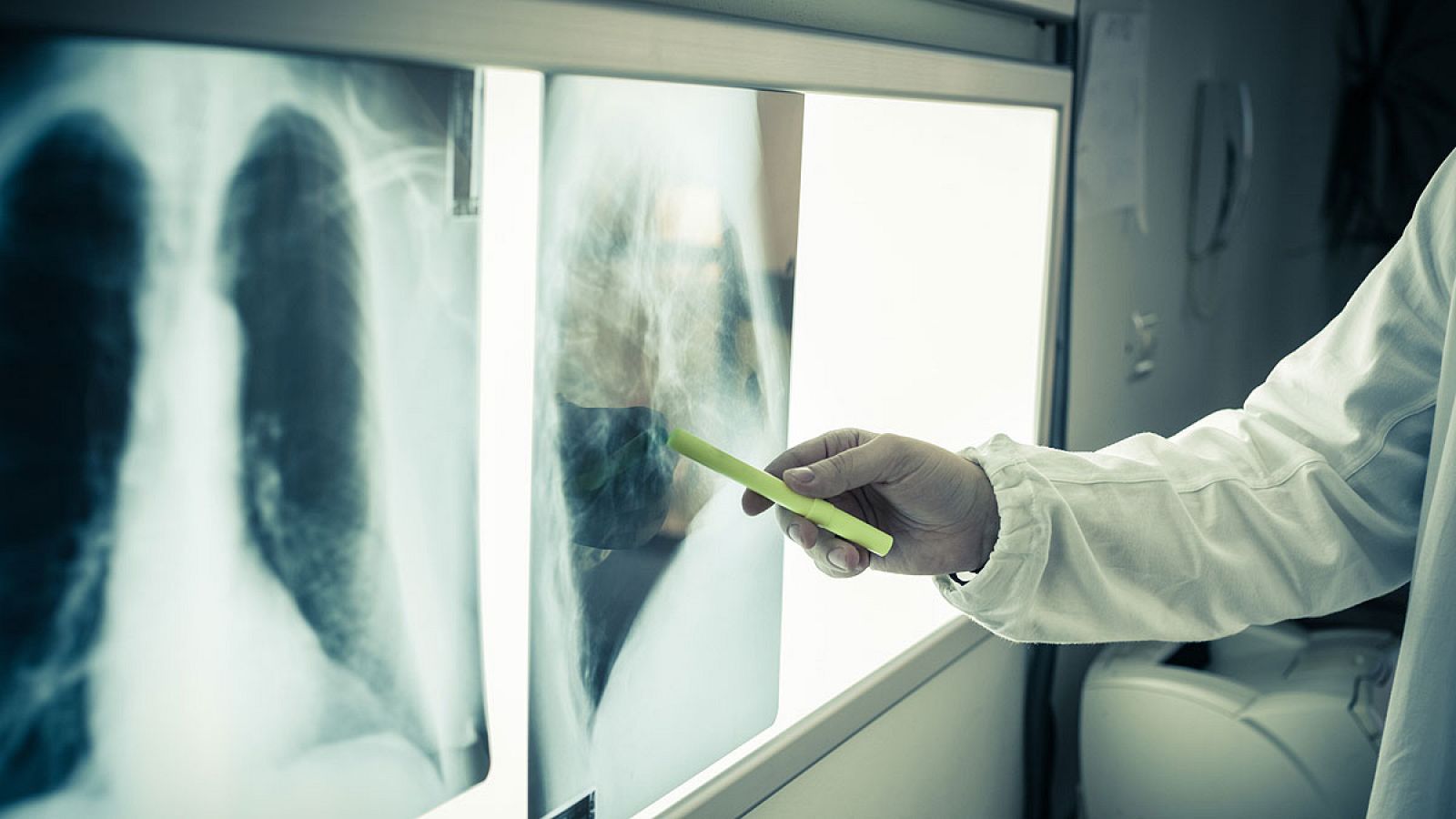 Radiografía de los pulmones de un paciente