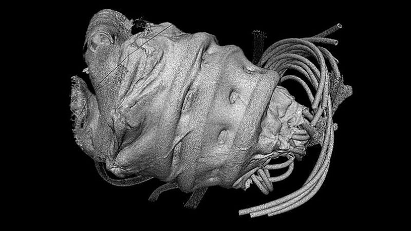 Un dispositivo robótico blando que ayuda al corazón a mantener su movimiento natural