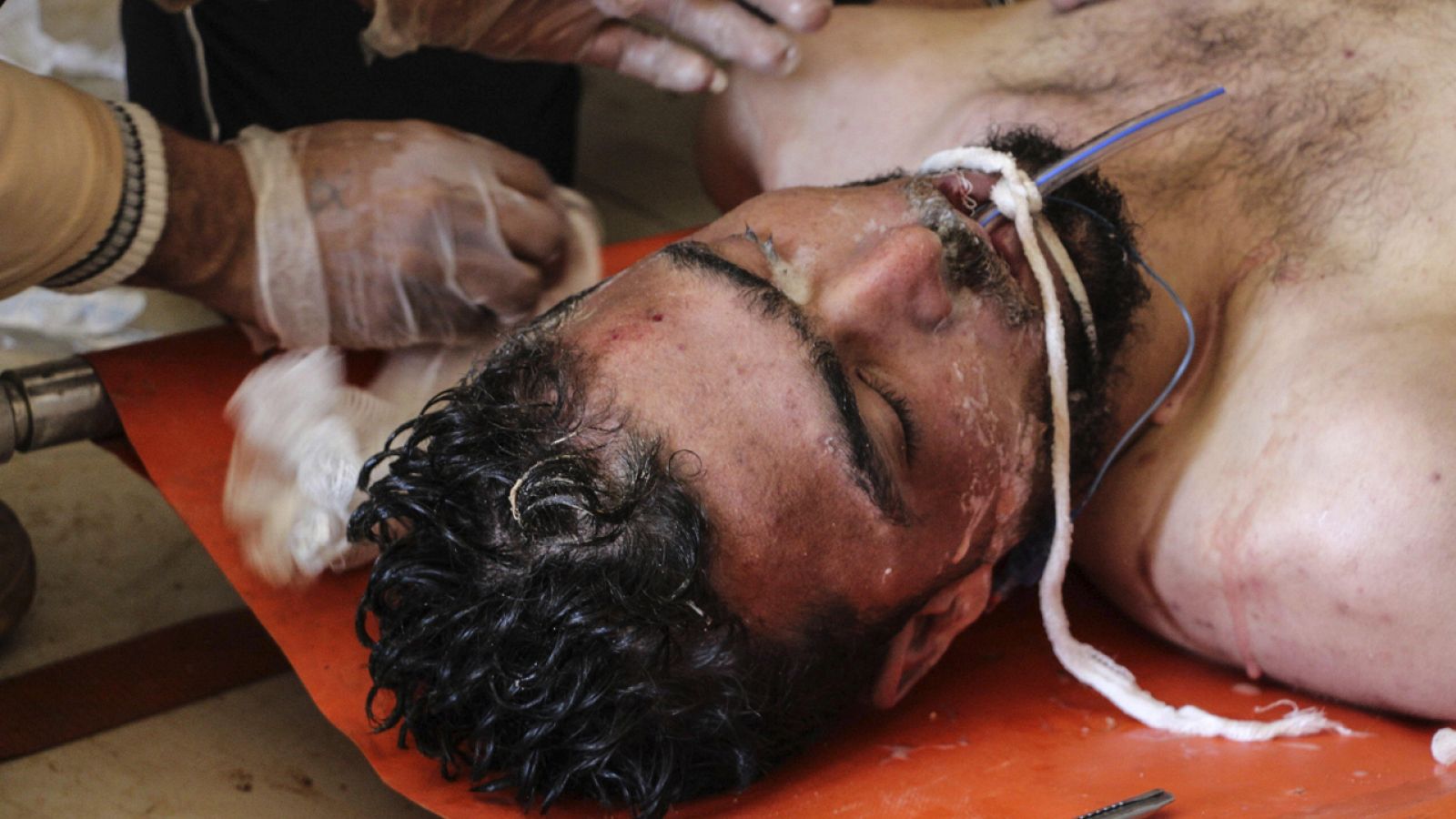 Un hombre recibe tratamiento médico tras un supuesto ataque químico contra la localidad de Jan Sheijun, en la provincia de Idlib