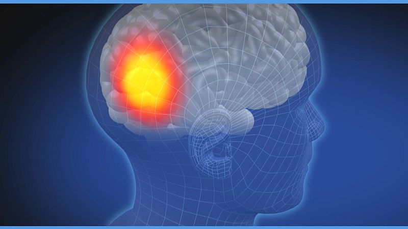 Imagen del cerebro de una persona Altamente Sensible