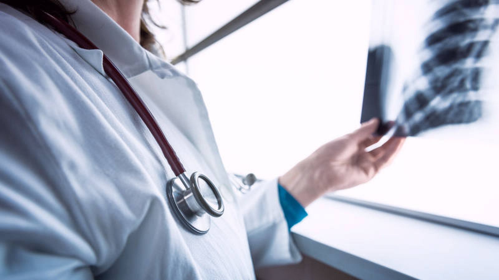 El cáncer de pulmón es el más frecuente por detrás del colorrectal y el de próstata