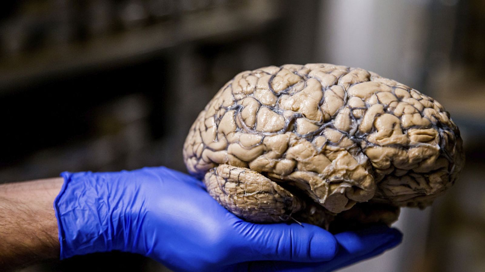 Un investigador mostrando un cerebro humano.