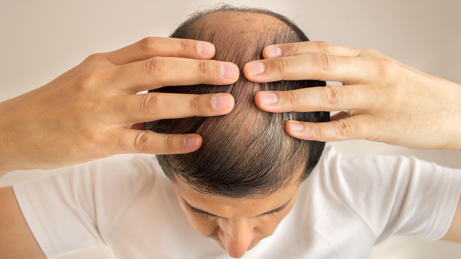 La tricología es la parte de la dermatología que se ocupa de los problemas de caída del cabello.