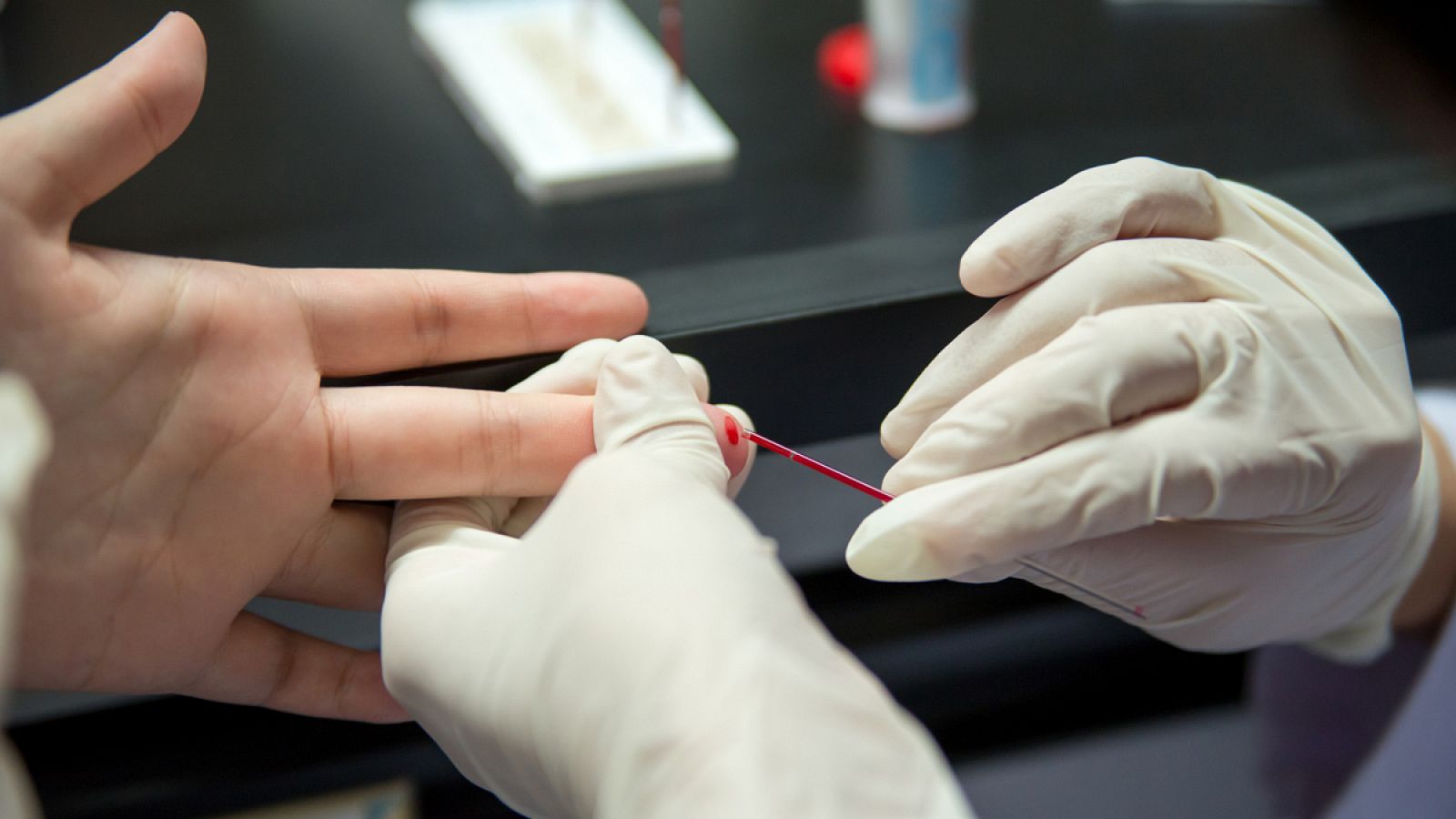 Extracción de una muestra de sangre para una prueba de VIH.