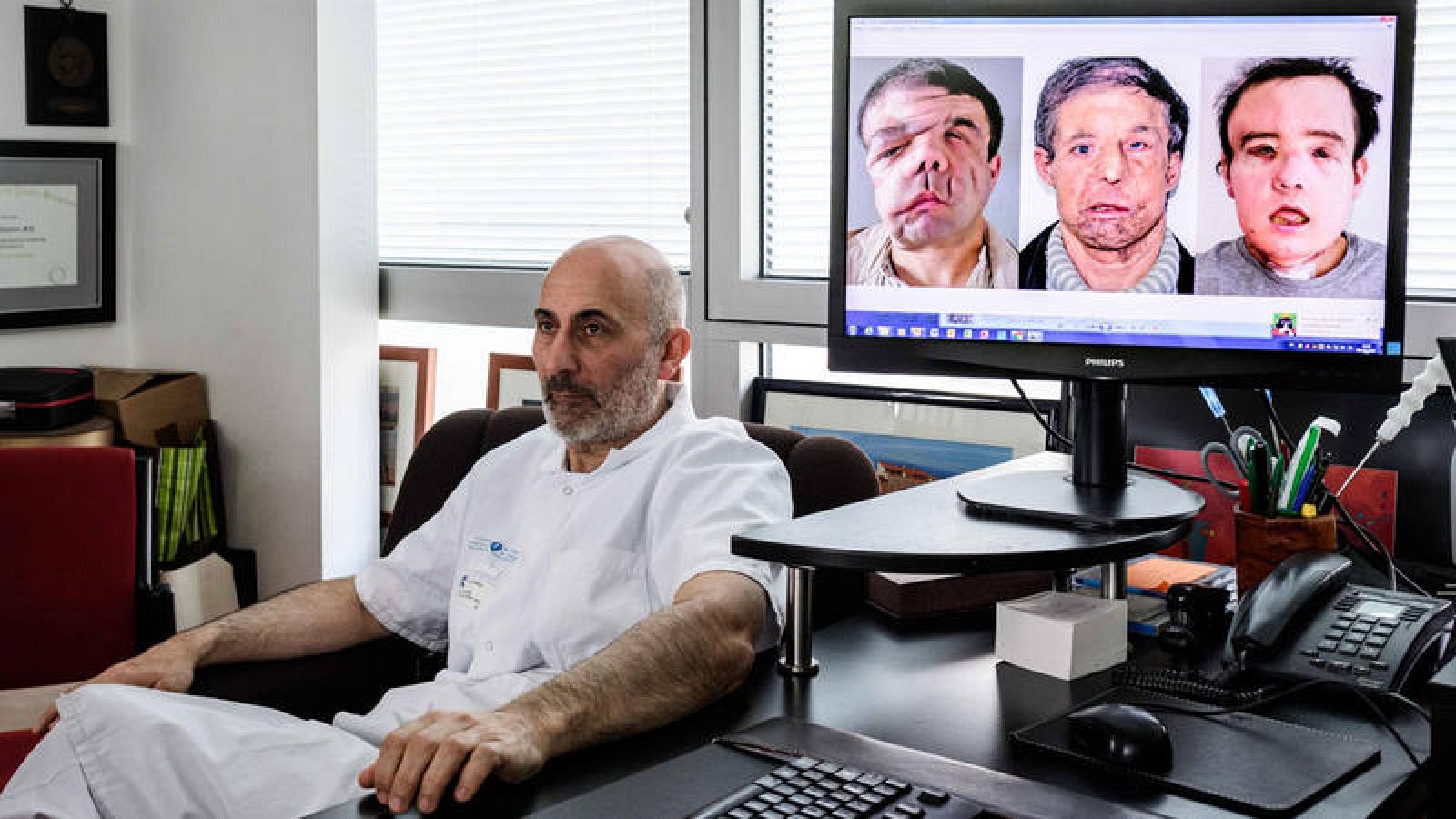 El jefe del equipo médico que ha realizado el segundo transplante de cara recibido por Jerôme Hamon, posa junto a una pantalla que muestra las tres caras que ha tenido su paciente