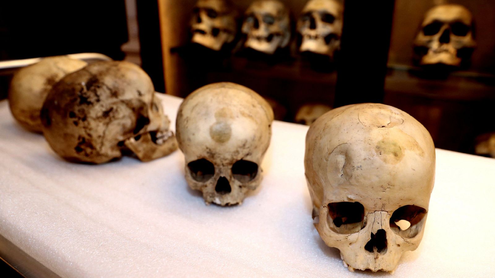Los cráneos proceden de varios yacimientos prehispánicos de Gran Canaria datados entre los siglos VI y XV.