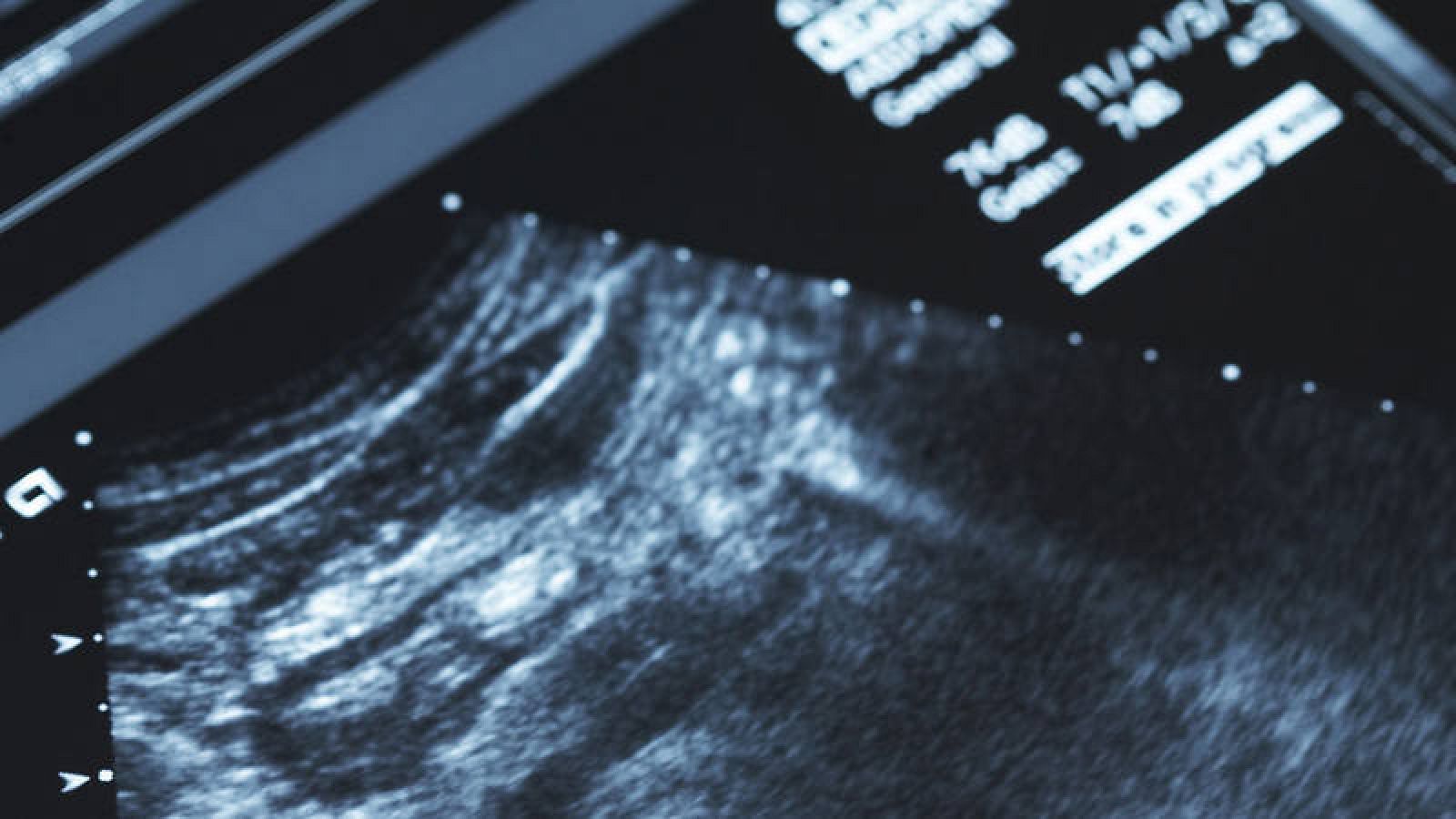 Imagen de archivo de una ecografía.