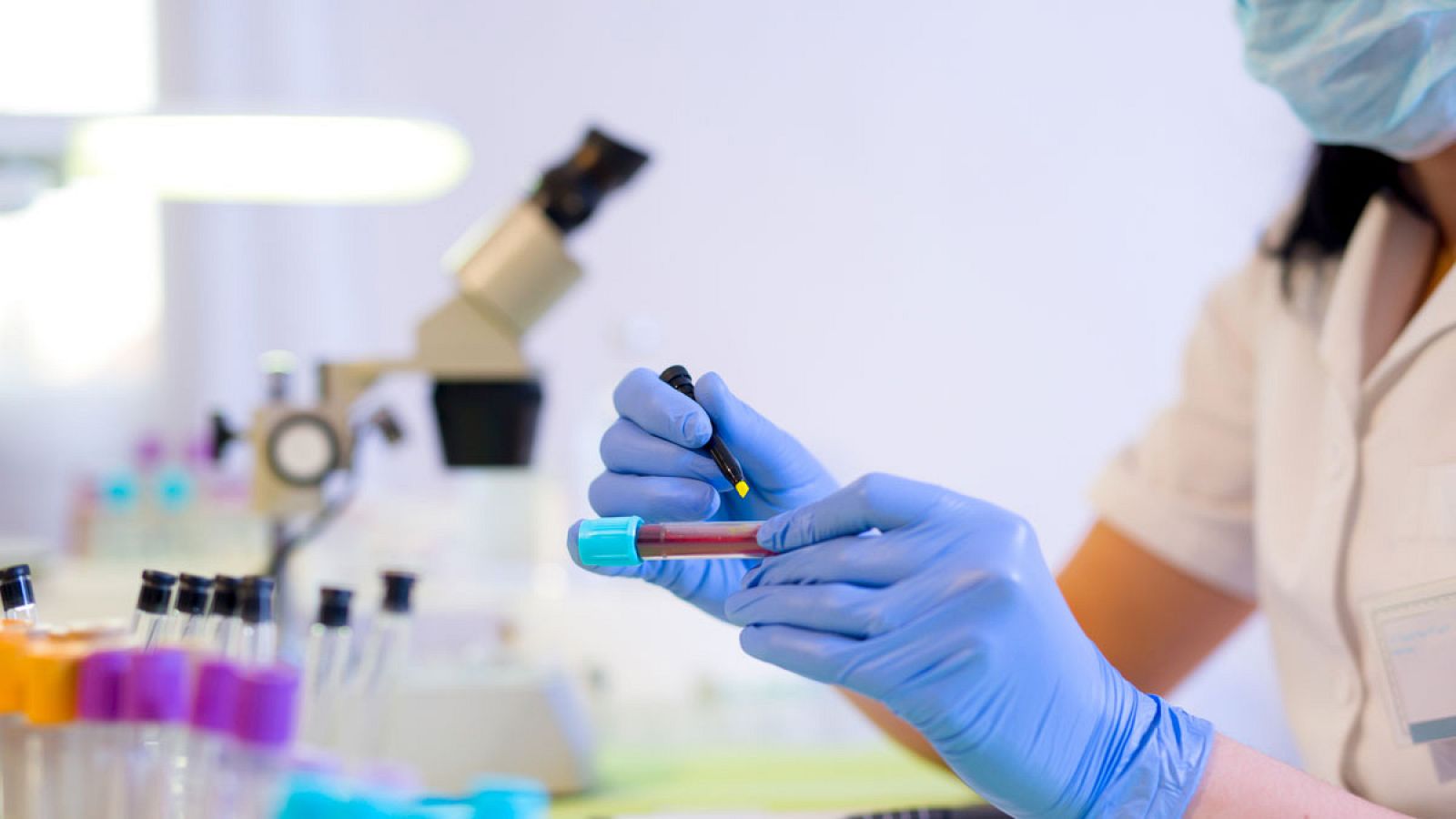 Los tumores que tienen mayor expresión de ADN en la sangre son los más frecuentes, como el de pulmón, mama, colon, próstata o páncreas.