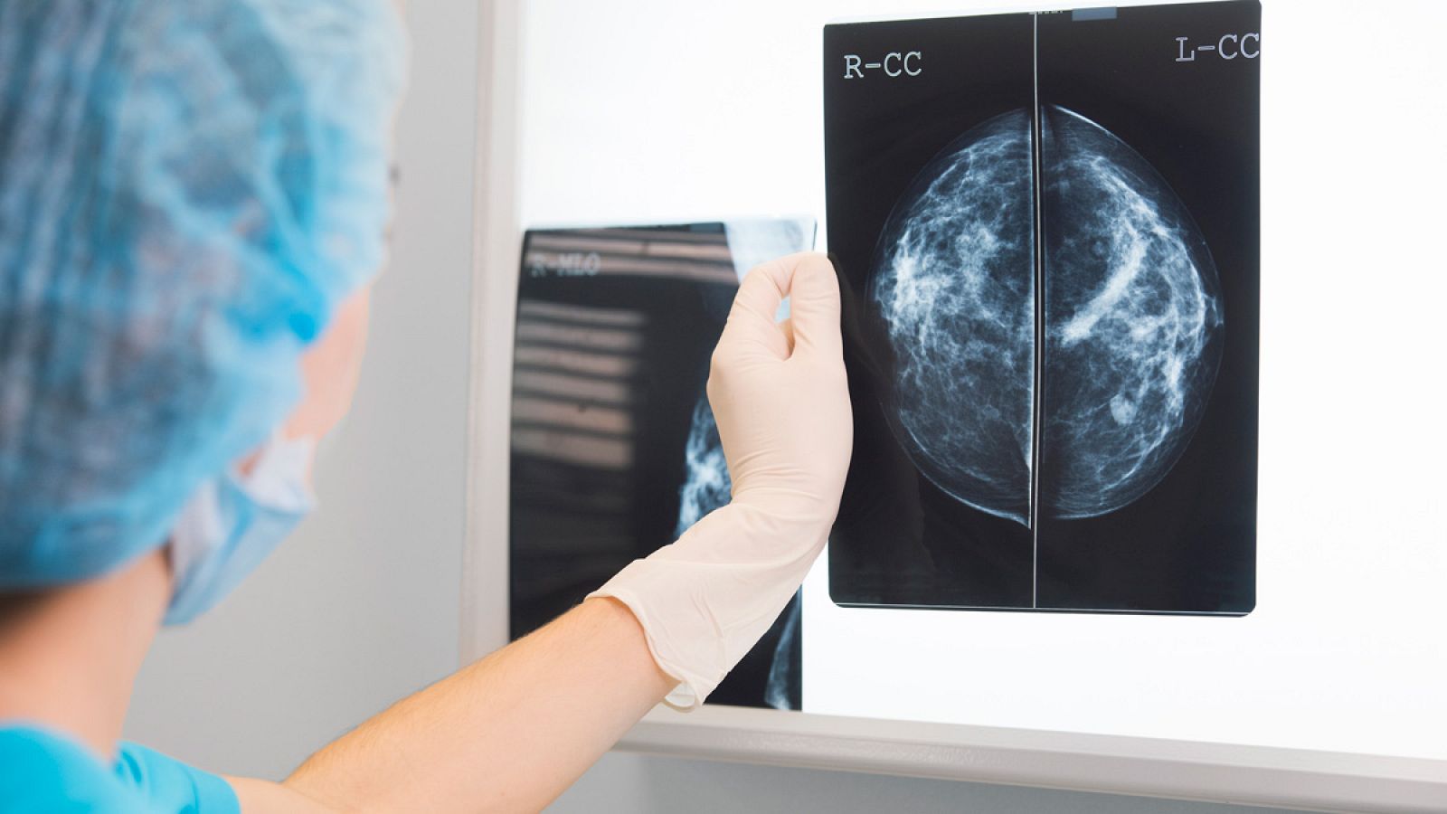 Investigadores del Vall d'Hebron logran avances en tratamientos contra el cáncer de mama
