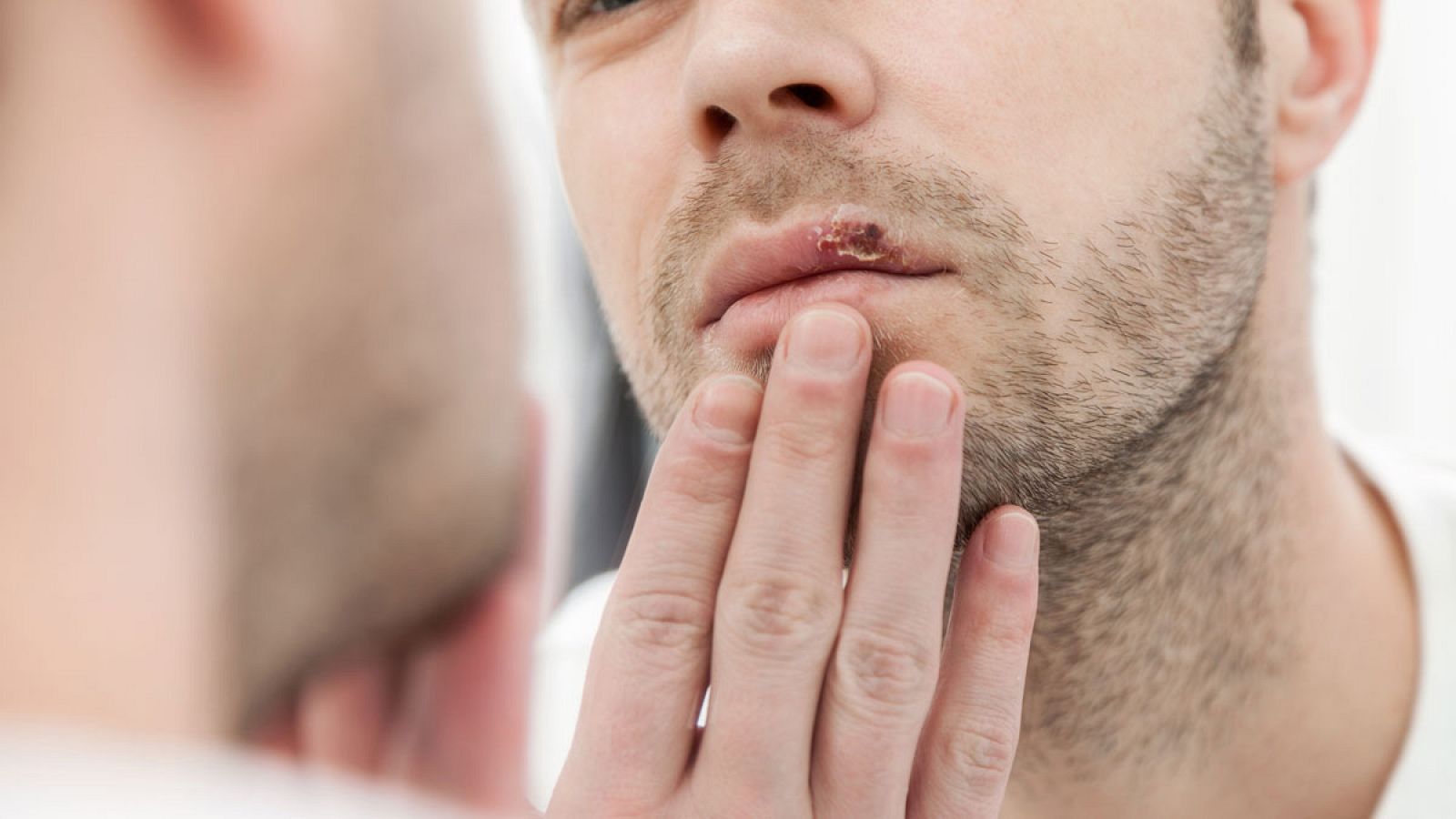 Los virus de herpes se reactivan cuando las personas afectadas están estresadas o enfermas.