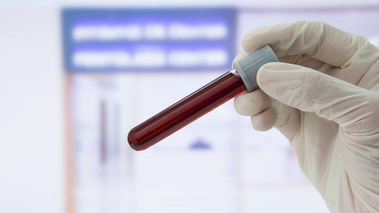 Solo el 30% de los pacientes consiguen controlar el colesterol tras un infarto.