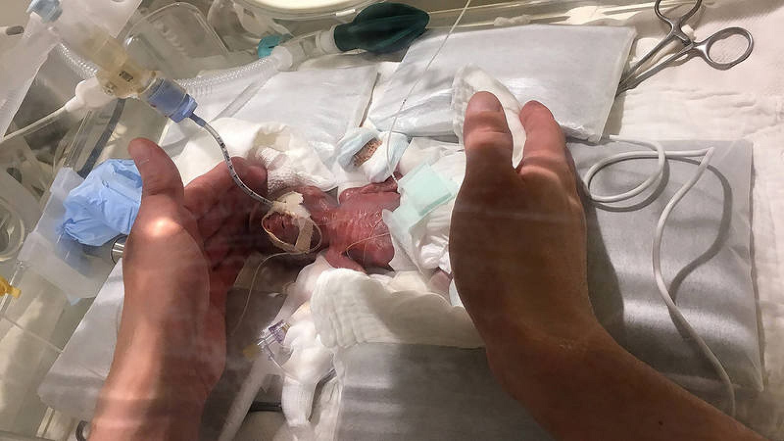 Ciencia Sale Del Hospital El Bebe Prematuro Mas Pequeno Del Mundo Que Nacio En Japon Pesando 268 Gramos