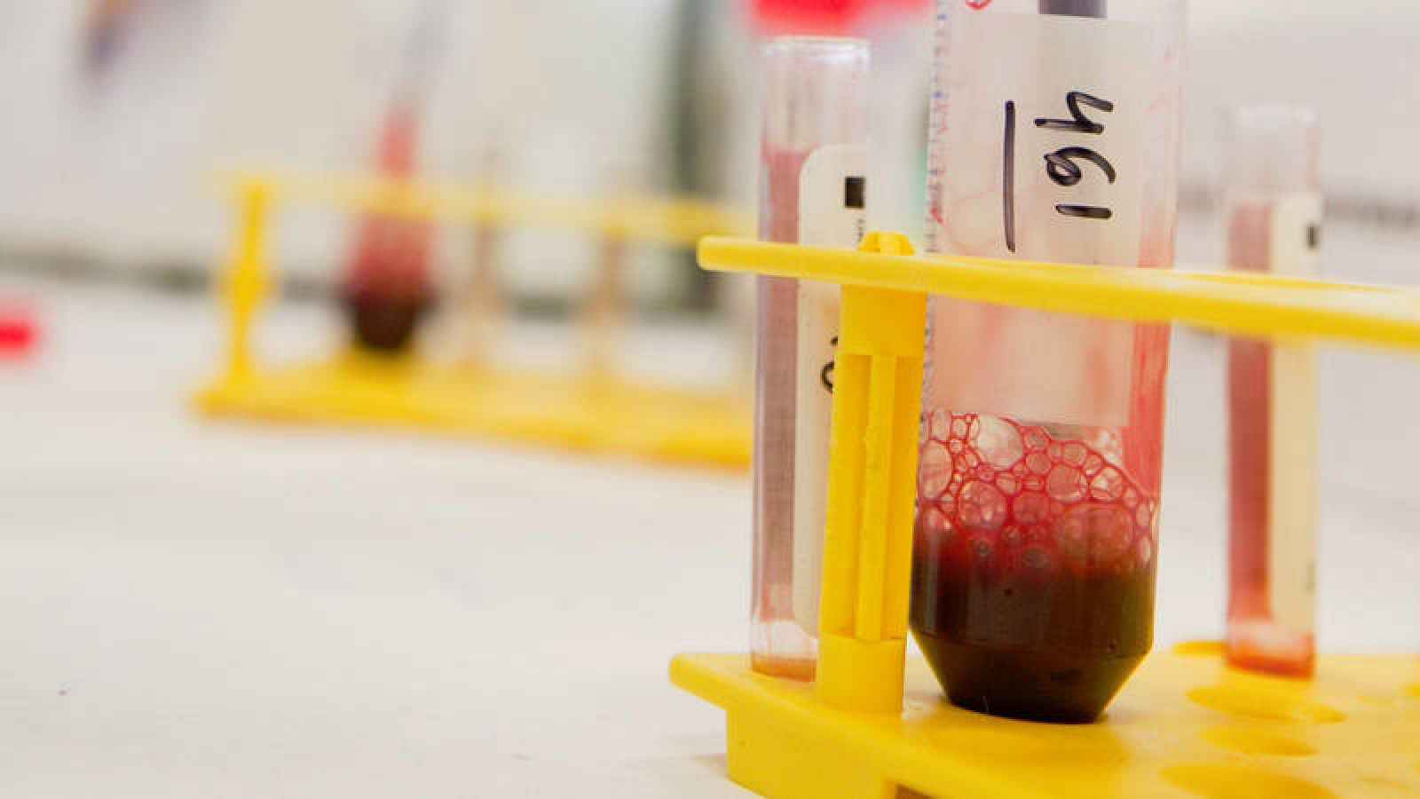 La donación de médula se rige por el principio de solidaridad universal, recuerdan desde la Organización Nacional de Trasplantes.