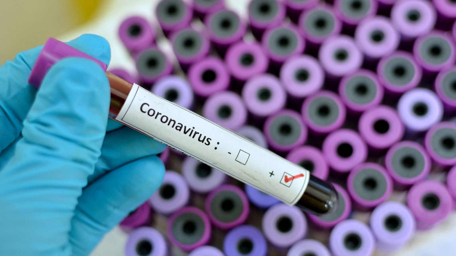 La OMS declara la emergencia sanitaria internacional por el coronavirus de Wuhan