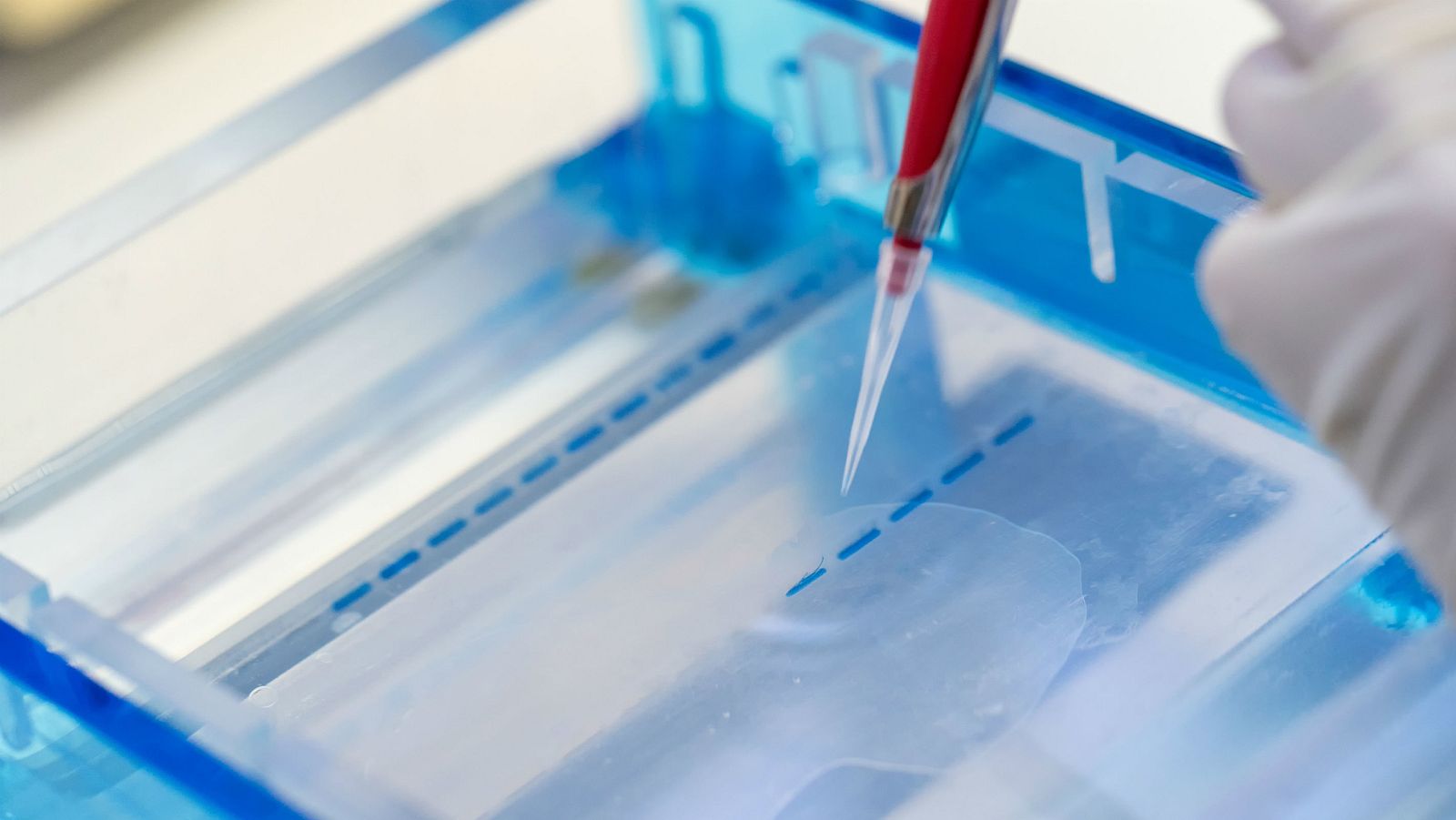 Asturias Registra Su Primer Positivo Por Coronavirus Tras 20 Dias