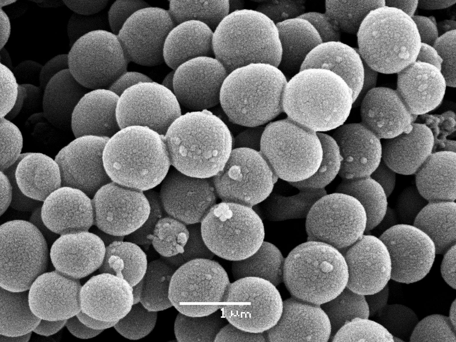Foto de una superbacteria 'Staphylococcus aureus', conocida como MRSA.