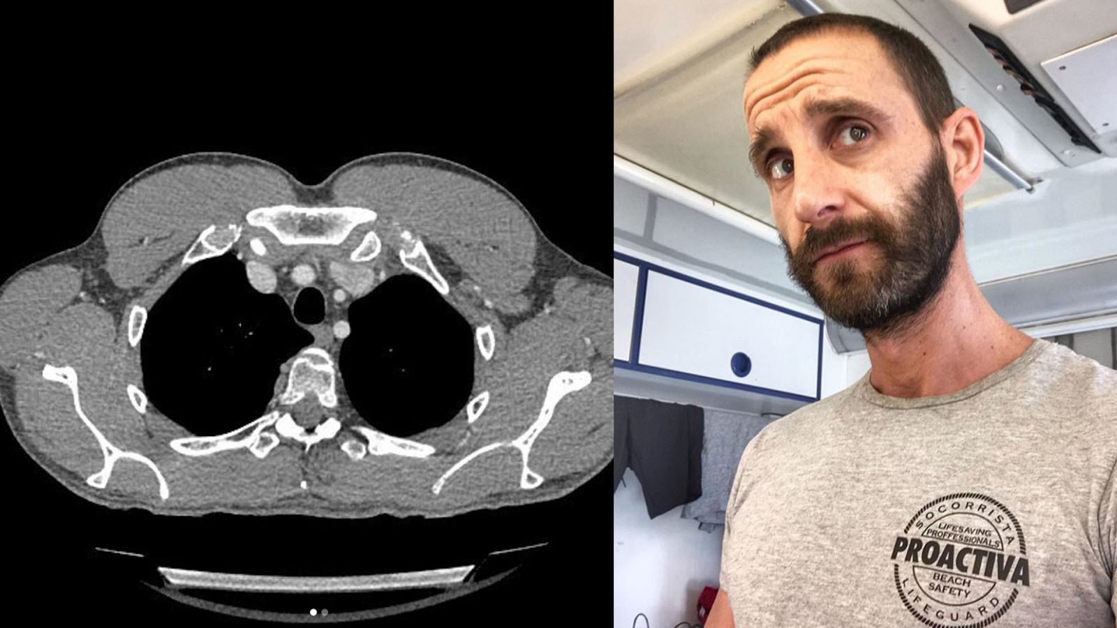  Dani Rovira, libre de cáncer tres meses después