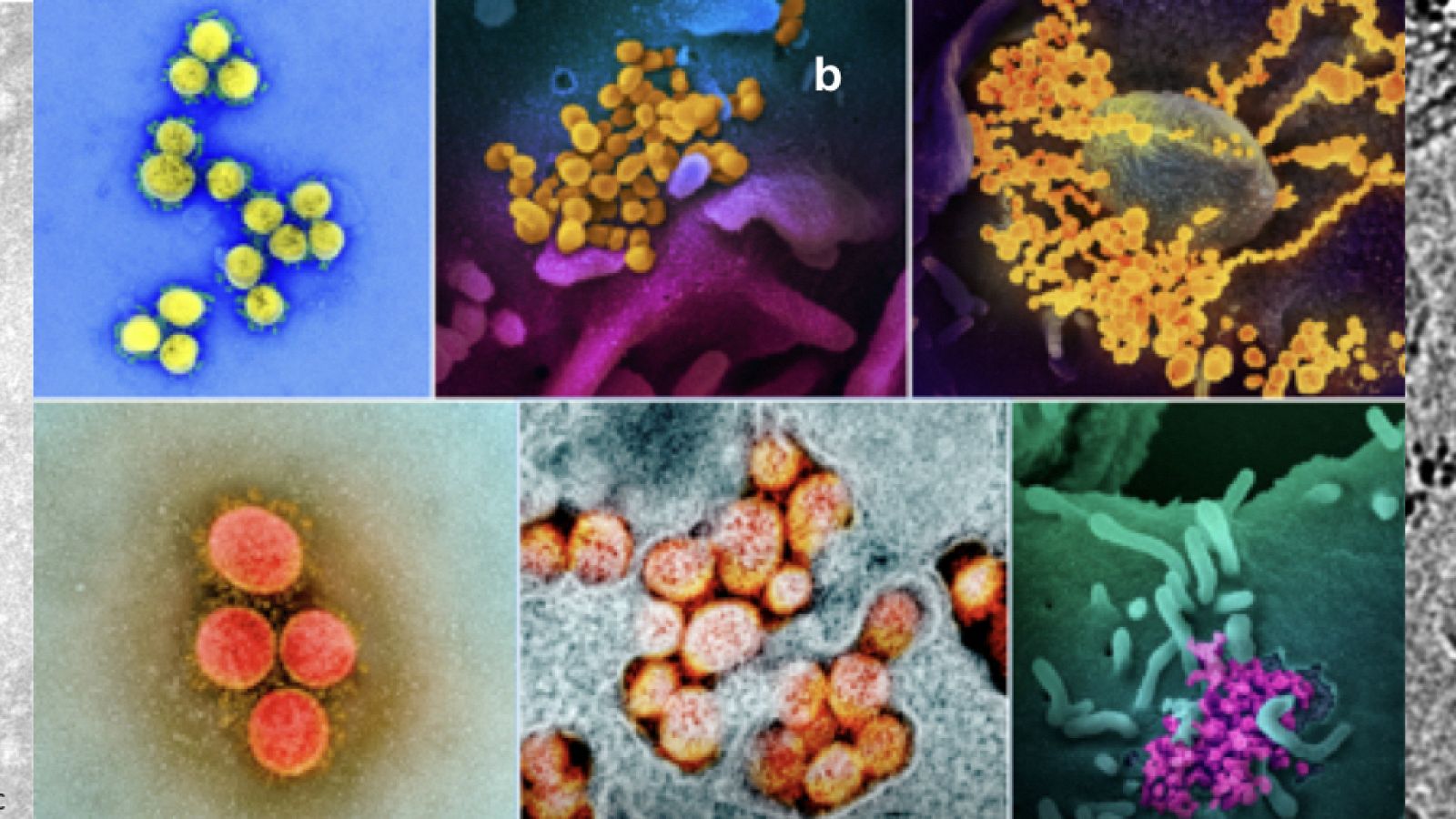 Primeras imágenes reales del SARS-CoV-2. CCDC (a); NIAID (b) y Cryo-EM Centre, Shenzhen, China (c).