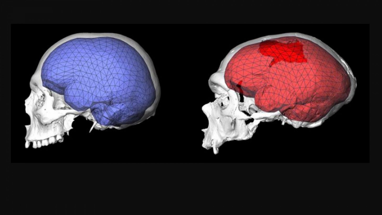 Diferencia entre un cerebro humano y uno neandertal